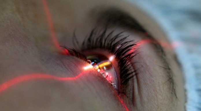 Лазерная коррекция зрения