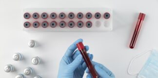 Обязательное медицинское обследование реципиентов трансфузий