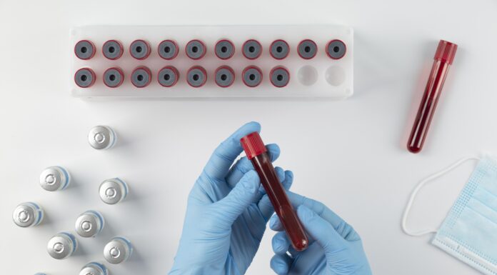 Обязательное медицинское обследование реципиентов трансфузий